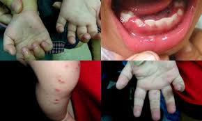 images (3)